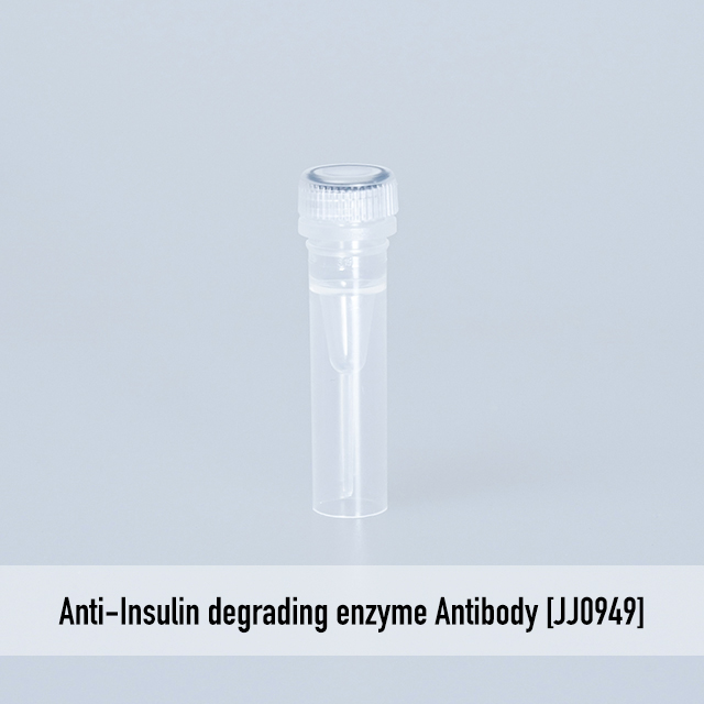 Anti-Insulin degrading enzyme Antibody [JJ0949]