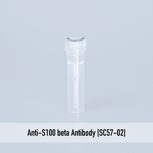 Anti-S100 beta Antibody [SC57-02]