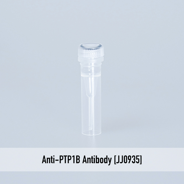 Anti-PTP1B Antibody [JJ0935]