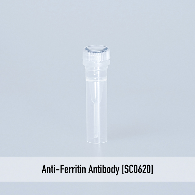 Anti-Ferritin Antibody [SC0620]