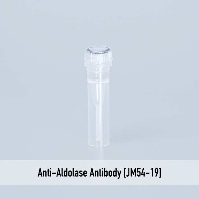Anti-Aldolase Antibody [JM54-19]